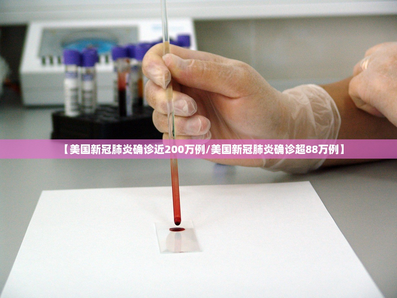 【美国新冠肺炎确诊近200万例/美国新冠肺炎确诊超88万例】