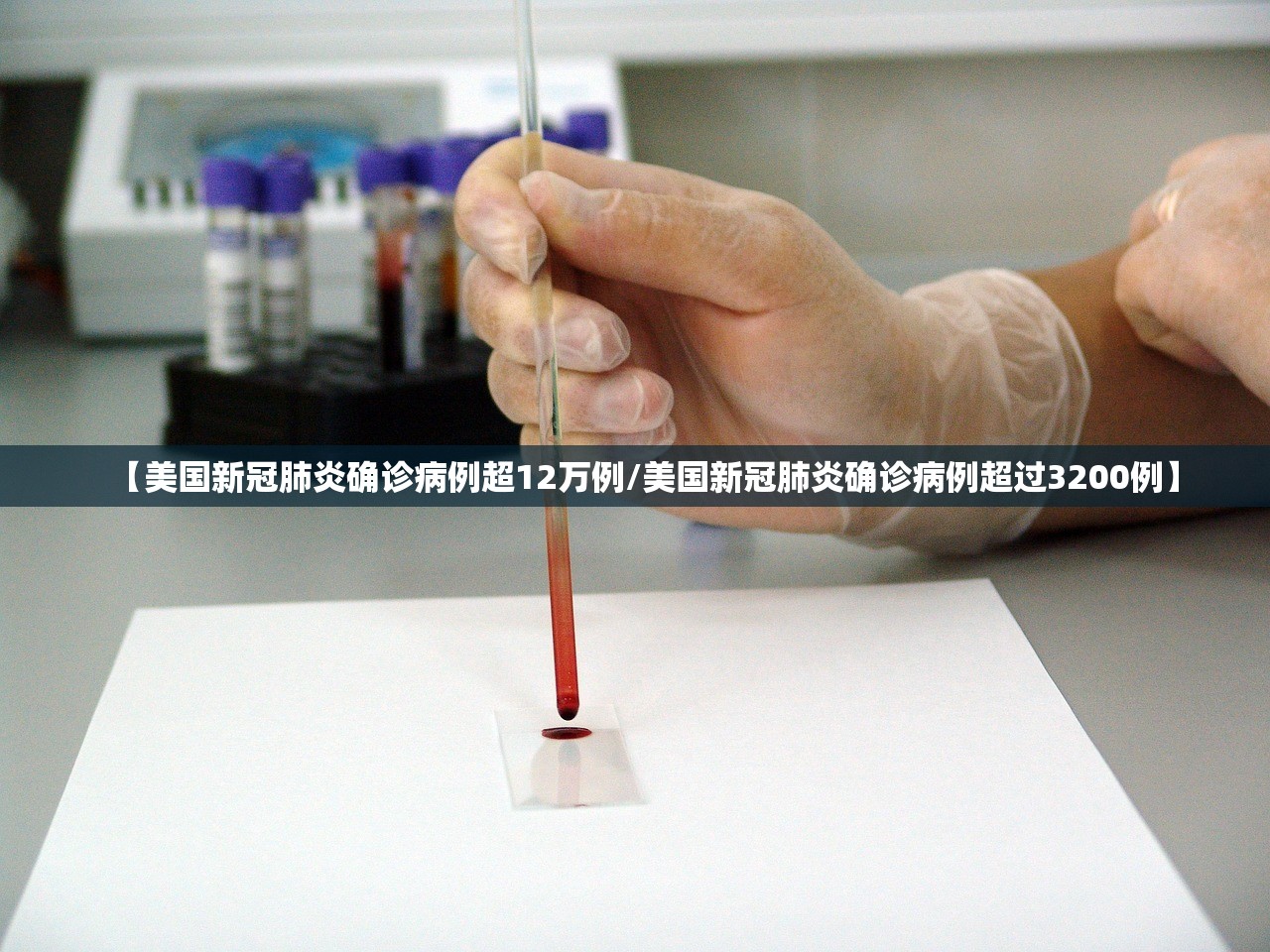 【美国新冠肺炎确诊病例超12万例/美国新冠肺炎确诊病例超过3200例】