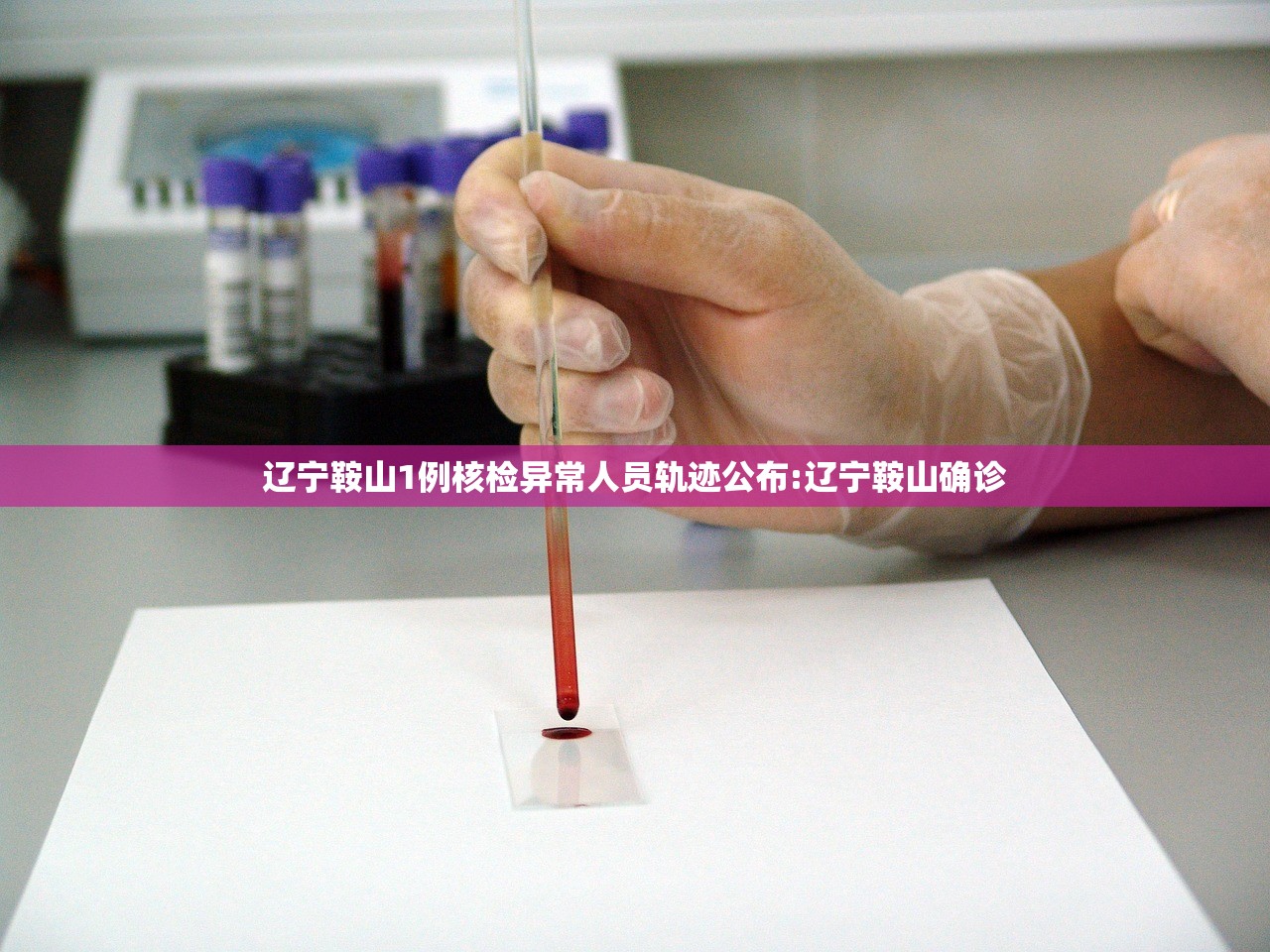 辽宁鞍山1例核检异常人员轨迹公布:辽宁鞍山确诊