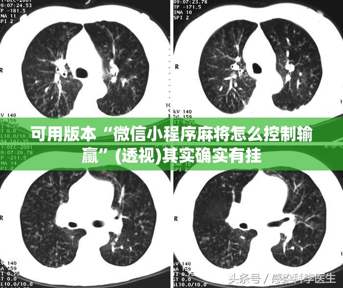 可用版本“微信小程序麻将怎么控制输赢”(透视)其实确实有挂