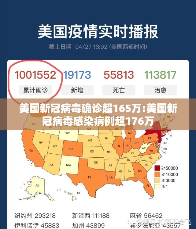 美国新冠病毒确诊超165万:美国新冠病毒感染病例超176万