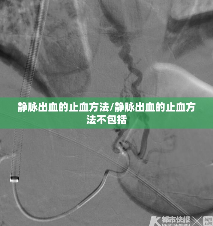 静脉出血的止血方法/静脉出血的止血方法不包括