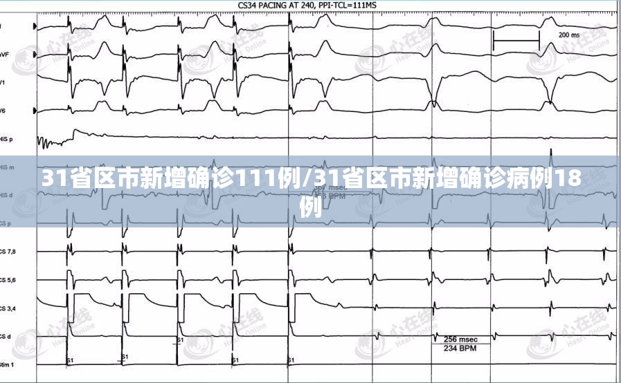 31省区市新增确诊111例/31省区市新增确诊病例18例 31省区市新增确诊111例/31省区市新增确诊病例18例