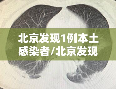 北京发现1例本土感染者/北京发现一例新冠肺炎 北京发现1例本土感染者/北京发现一例新冠肺炎