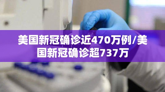 美国新冠确诊近470万例/美国新冠确诊超737万