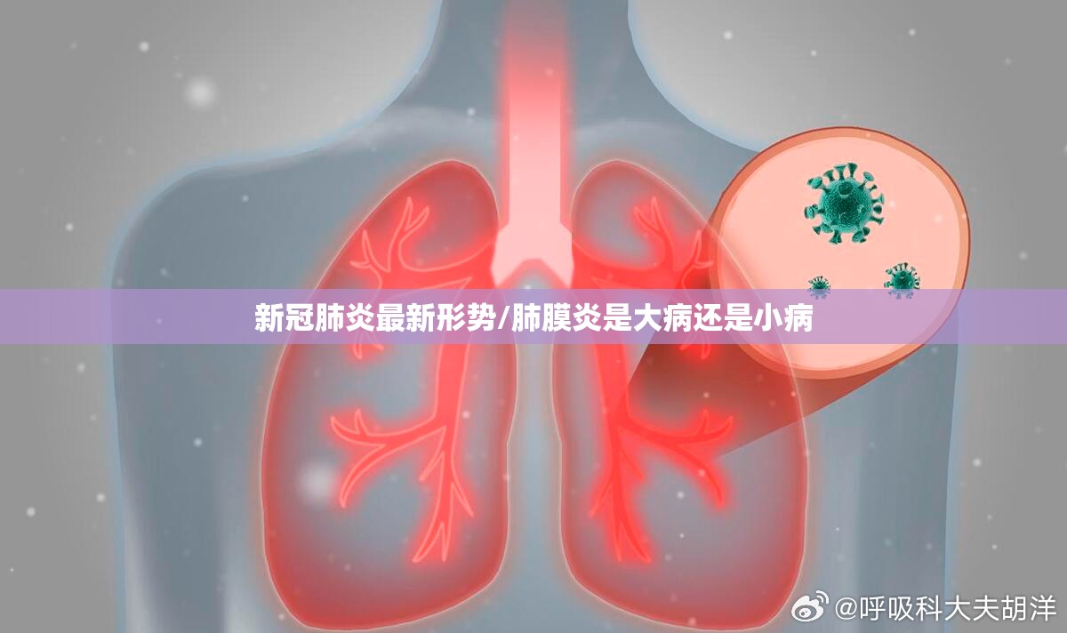 新冠肺炎最新形势/肺膜炎是大病还是小病 新冠肺炎最新形势/肺膜炎是大病还是小病
